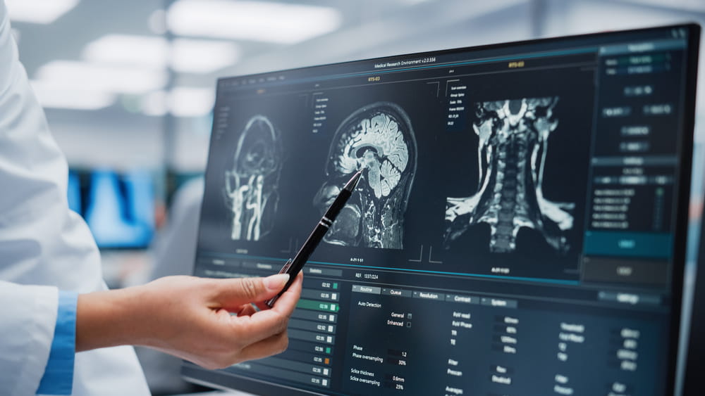 Brain Injuries